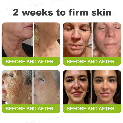 ✨👨‍⚕️Made and shipped from the UK 💫Rolimey® Botox & Vita-A Retinol Shot Wrinkle-Lift Tightening cream - Last Day Promotion 70% OFF