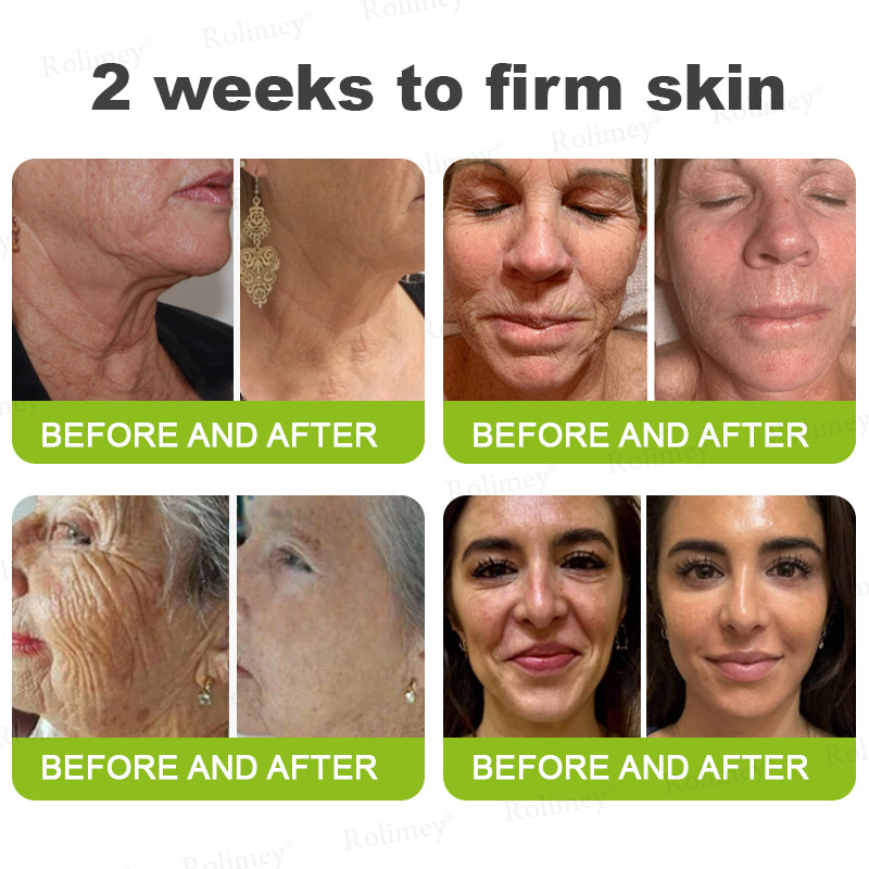 👨‍⚕️Made and shipped from the UK ✅ Rolimey® Botox & Vita-A Retinol Shot Wrinkle-Lift Tightening stick