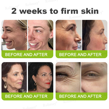 👨‍⚕️Made and shipped from the UK ✅ Rolimey® Botox & Vita-A Retinol Shot Wrinkle-Lift Tightening stick