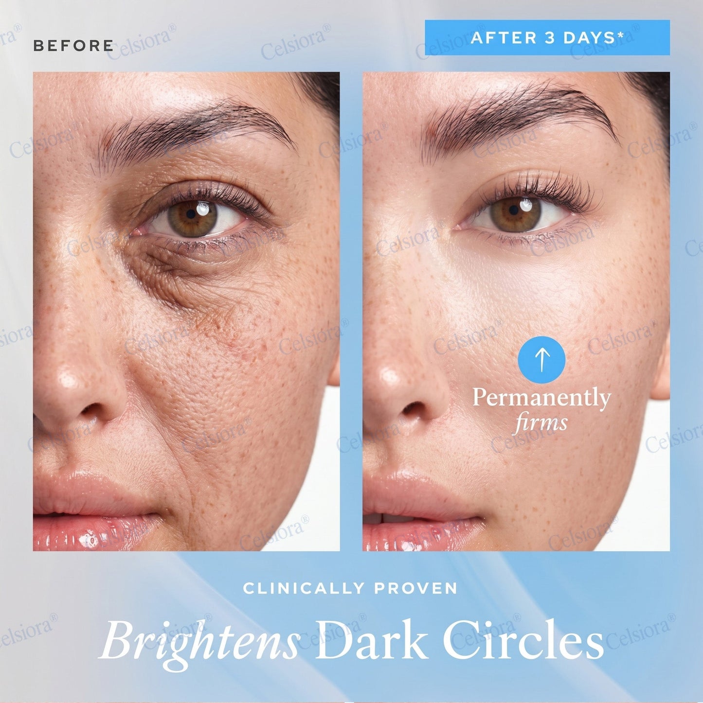 UK HOT SALES💫Celsiora® Botox & PDRN Anti-Wrinkle Shot – Lift & Firming Cream
