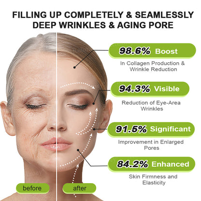 👍Rolimey® Botox & Vita-A Retinol Shot Wrinkle-Lift Tightening Cream