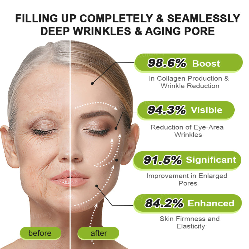 ✨👨‍⚕️Made and shipped from the UK 💫Rolimey® Botox & Vita-A Retinol Shot Wrinkle-Lift Tightening cream - Last Day Promotion 70% OFF