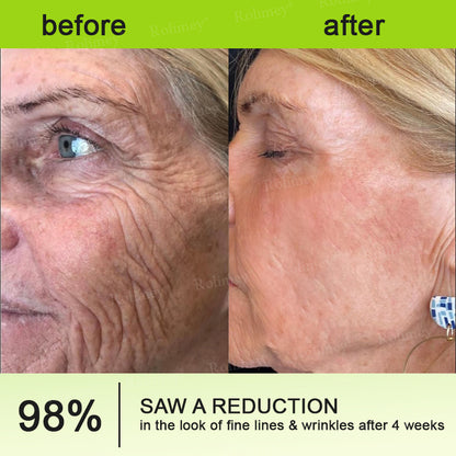 ✨👨‍⚕️Made and shipped from the UK 💫Rolimey® Botox & Vita-A Retinol Shot Wrinkle-Lift Tightening cream - Last Day Promotion 70% OFF