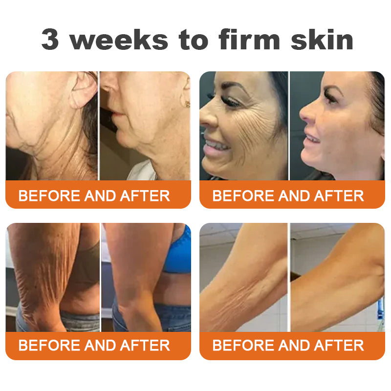 💐🧡Made and Shipped from UK✨Flysmus™ Botox Bee Venom Firming Serum Stick🔥LAST DAY 70% OFF