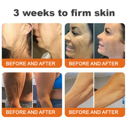 💐🧡Made and Shipped from UK✨Flysmus™ Botox Bee Venom Firming Serum Stick🔥LAST DAY 70% OFF