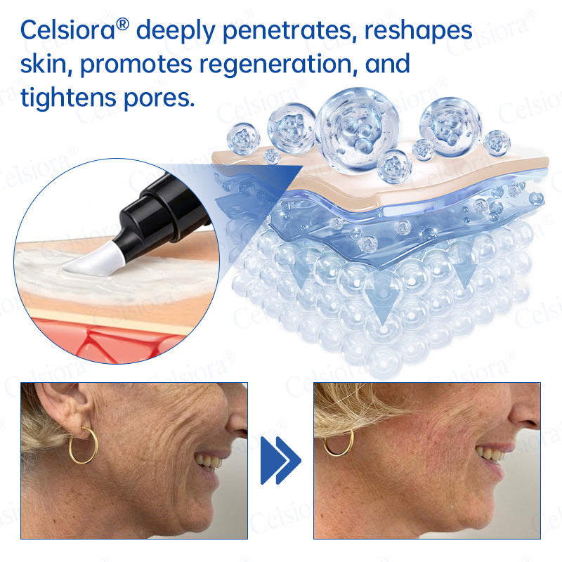 UK HOT SALES💫Celsiora® Botox & PDRN Anti-Wrinkle Shot – Lift & Firming Cream