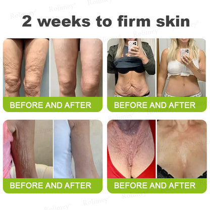 ✨👨‍⚕️Made and shipped from the UK 💫Rolimey® Botox & Vita-A Retinol Shot Wrinkle-Lift Tightening cream - Last Day Promotion 70% OFF