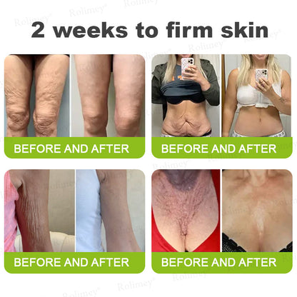 👍Rolimey® Botox & Vita-A Retinol Shot Wrinkle-Lift Tightening Cream