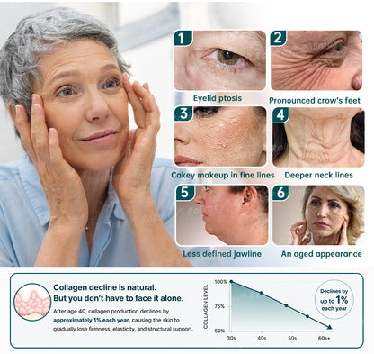 Rolimey® Botox & Stem Cell Wrinkle-Lift Tightening Cream