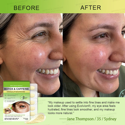 💛UK HOT SALES ✨Evolvion® Botox & Caffeine Wrinkle-Lift Eye Patches