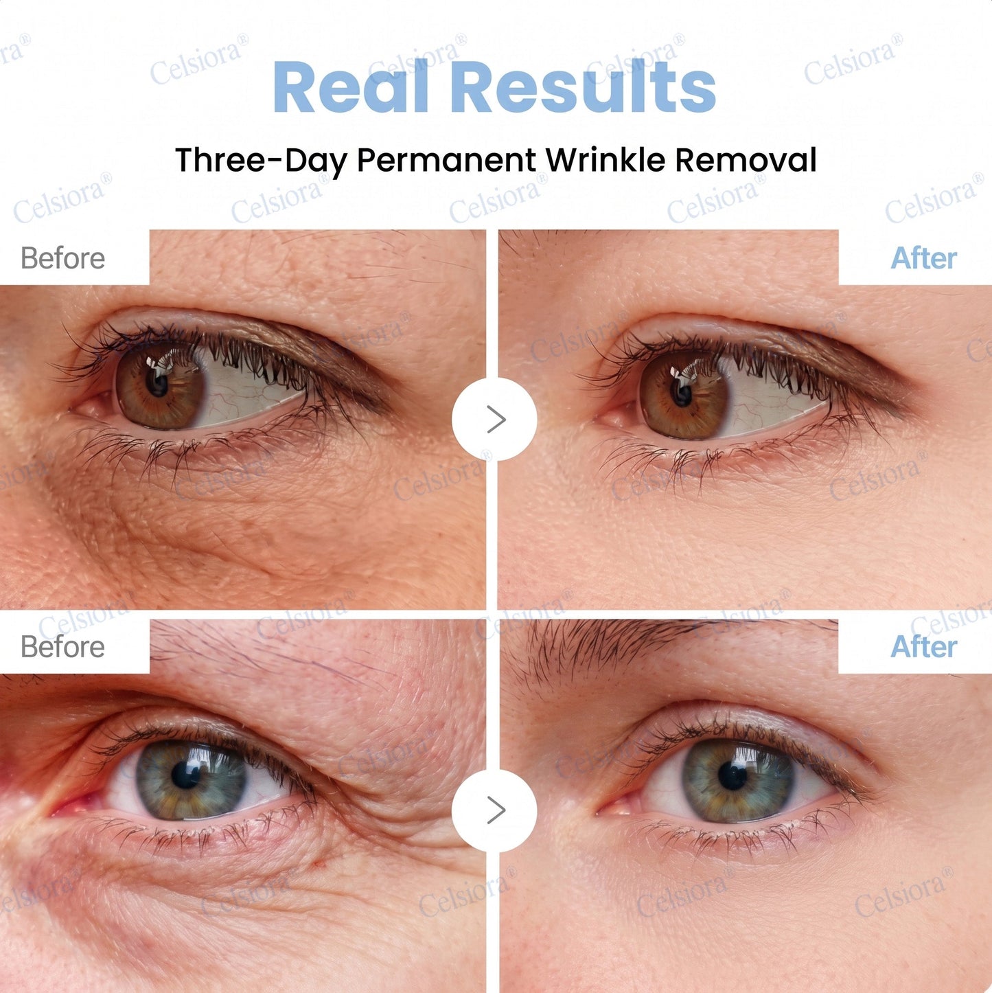 UK HOT SALES💫Celsiora® Botox & PDRN Anti-Wrinkle Shot – Lift & Firming Cream