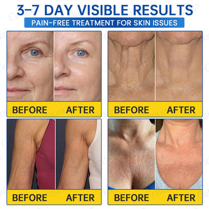 UK HOT SALES💫Celsiora® Botox & PDRN Anti-Wrinkle Shot – Lift & Firming Cream