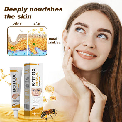 ✨🍀Made and shipped from the UK ✅Flysmus® Botox Bee Venom Wrinkle Removal Cream-Last Day Promotion 70% OFF