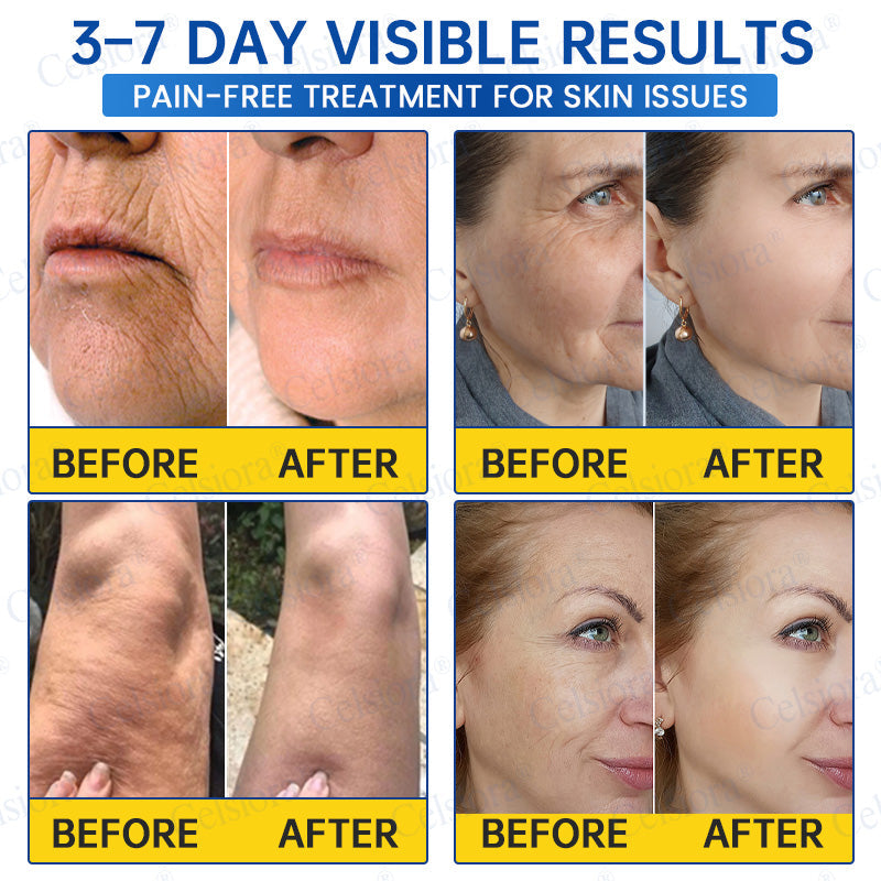 UK HOT SALES💫Celsiora® Botox & PDRN Anti-Wrinkle Shot – Lift & Firming Cream