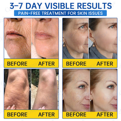 UK HOT SALES💫Celsiora® Botox & PDRN Anti-Wrinkle Shot – Lift & Firming Cream