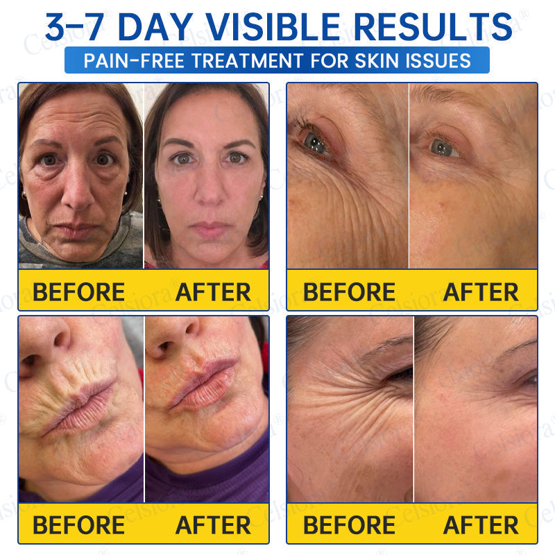 UK HOT SALES💫Celsiora® Botox & PDRN Anti-Wrinkle Shot – Lift & Firming Cream