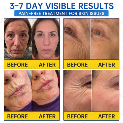 UK HOT SALES💫Celsiora® Botox & PDRN Anti-Wrinkle Shot – Lift & Firming Cream