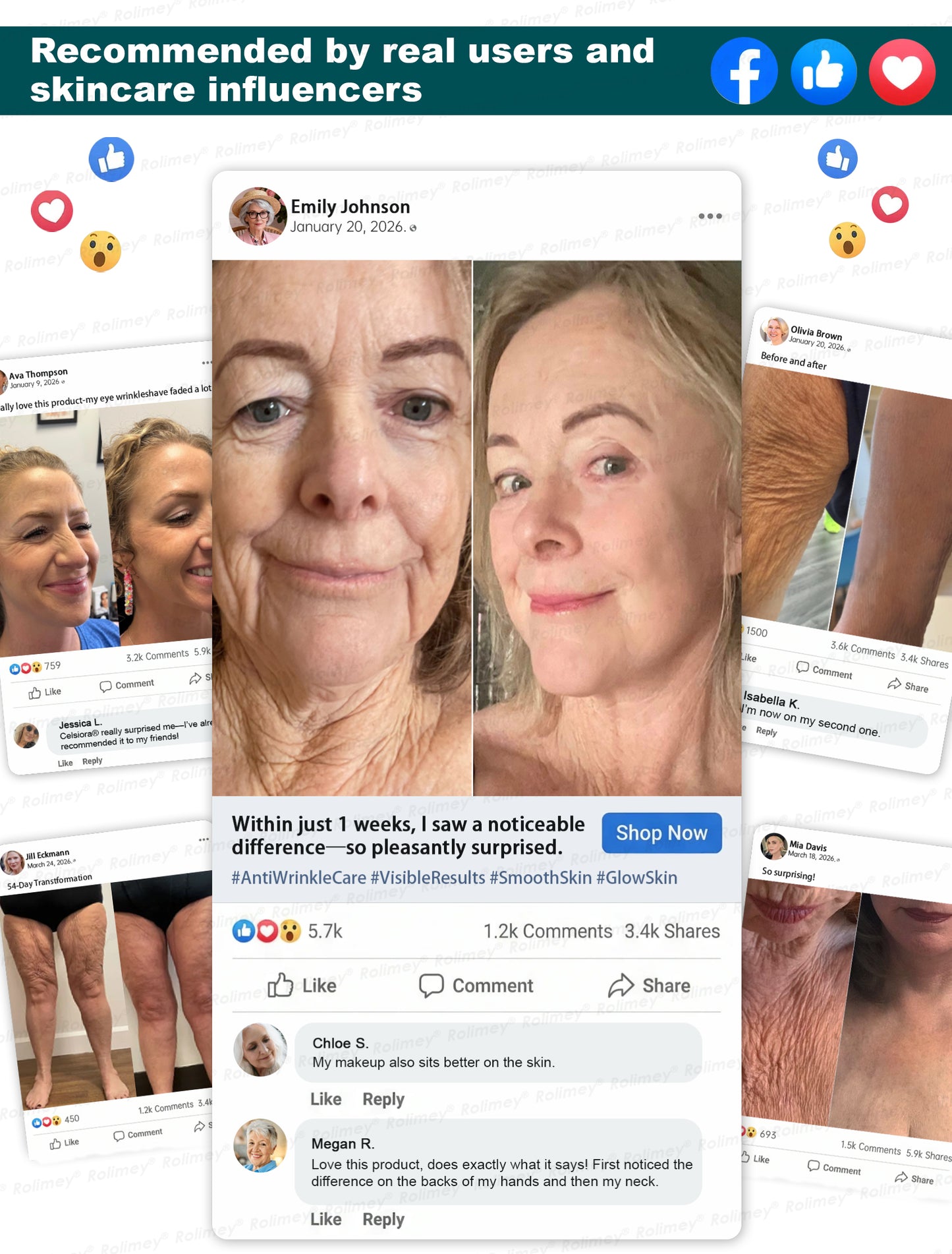 Rolimey® Botox & Stem Cell Wrinkle-Lift Tightening Cream