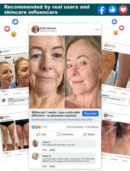 Rolimey® Botox & Stem Cell Wrinkle-Lift Tightening Cream