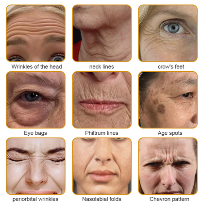 ✨🍀Made and shipped from the UK ✅Flysmus® Botox Bee Venom Wrinkle Removal Cream-Last Day Promotion 70% OFF