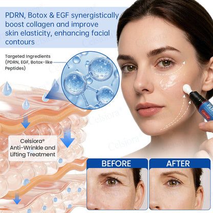 UK HOT SALES💫Celsiora® Botox & PDRN Anti-Wrinkle Shot – Lift & Firming Cream