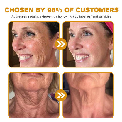 ✨🍀Made and shipped from the UK ✅Flysmus® Botox Bee Venom Wrinkle Removal Cream-Last Day Promotion 70% OFF