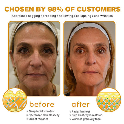 ✨🍀Made and shipped from the UK ✅Flysmus® Botox Bee Venom Wrinkle Removal Cream-Last Day Promotion 70% OFF